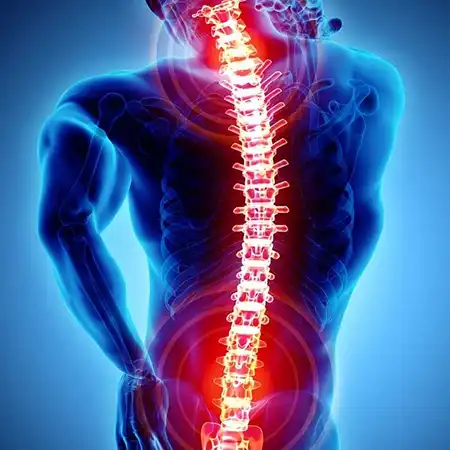 Spinal stenosis and degenerative conditions